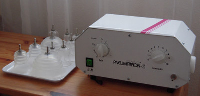 Pneumatische Pulsationstherapie (PPT), nach Deny